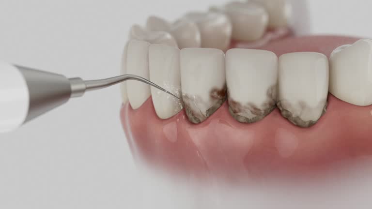 Reliable Dental Implants contractor in Four Corners, MT by Smile Center Dentistry